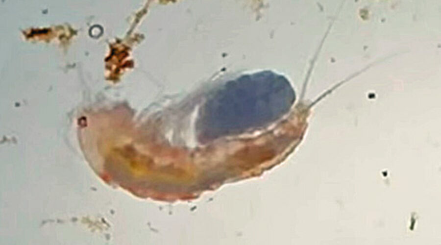 Copepod With Eggs